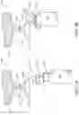 Fig. 02 - SYSTEMS AND METHODS FOR DECONTAMINATED ENGAGEMENT OF VESSELS USING A DISPLACEABLE PLATE