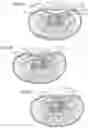 Fig. 05 - Therapeutic skin lifting device and related systems and methods