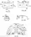 Fig. 06 - Therapeutic skin lifting device and related systems and methods