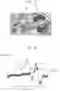 Fig. 04 - Endoscope surgery device