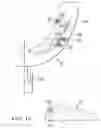 Fig. 13 - System and method for correcting malocclusion
