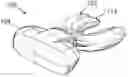 Fig. 01 - SYSTEMS AND METHODS FOR REDUCING ROOT RESORPTION IN ORTHODONTIC TREATMENT