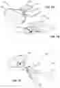 Fig. 02 - SYSTEMS AND METHODS FOR REDUCING ROOT RESORPTION IN ORTHODONTIC TREATMENT