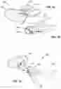 Fig. 02 - APPARATUSES AND METHODS FOR PRESERVATION OF LOOSE DENTITION