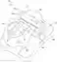 Fig. 01 - Adjustable-prescription orthodontic bracket assemblies