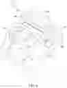 Fig. 04 - Adjustable-prescription orthodontic bracket assemblies