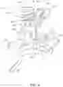 Fig. 05 - Adjustable-prescription orthodontic bracket assemblies