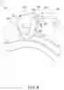 Fig. 07 - Adjustable-prescription orthodontic bracket assemblies