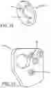 Fig. 07 - DENTAL ARTICULATOR CAPABLE OF FIXED HORIZONTAL CONDYLE AND ADJUSTABLE HORIZONTAL CONDYLE