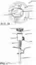 Fig. 09 - DENTAL ARTICULATOR CAPABLE OF FIXED HORIZONTAL CONDYLE AND ADJUSTABLE HORIZONTAL CONDYLE