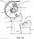 Fig. 13 - DENTAL ARTICULATOR CAPABLE OF FIXED HORIZONTAL CONDYLE AND ADJUSTABLE HORIZONTAL CONDYLE