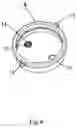 Fig. 05 - Filter unit for suction systems of dental equipment