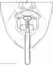 Fig. 01 - Dental measuring instrument