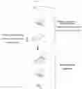 Fig. 03 - OCCLUSION RECORDING INSTRUMENT AND ARTICULATOR
