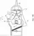 Fig. 06 - INFERIOR VENA CAVA FILTER RETRIEVAL DEVICE AND METHOD OF RETRIEVING SAME