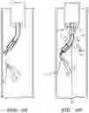 Fig. 10 - INFERIOR VENA CAVA FILTER RETRIEVAL DEVICE AND METHOD OF RETRIEVING SAME