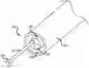 Fig. 01 - Methods And Devices For Anchoring A Gastroenterologic Sleeve