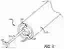 Fig. 06 - Methods And Devices For Anchoring A Gastroenterologic Sleeve