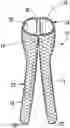 Fig. 01 - Bifurcated medical device for treating a target site and associated method