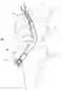 Fig. 01 - Ligament fixation device and method