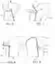 Fig. 04 - Ligament fixation device and method