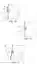 Fig. 05 - Ligament fixation device and method