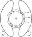 Fig. 01 - Intraocular lens and methods for implanting the same