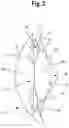 Fig. 03 - Intraocular lens and methods for implanting the same