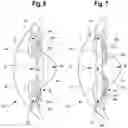 Fig. 05 - Intraocular lens and methods for implanting the same