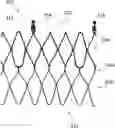 Fig. 01 - Attachment of leaflets to prosthetic heart valve