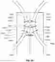 Fig. 11 - Attachment of leaflets to prosthetic heart valve