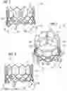 Fig. 02 - Prosthetic heart valve
