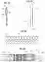 Fig. 19 - Prosthetic heart valve