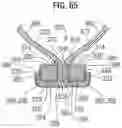 Fig. 23 - Prosthetic heart valve