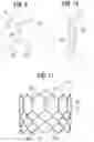 Fig. 04 - Prosthetic heart valve