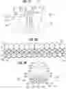 Fig. 10 - Prosthetic heart valve