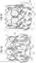 Fig. 16 - Prosthetic heart valve
