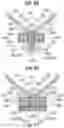Fig. 24 - Prosthetic heart valve