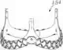 Fig. 01 - Assembly of heart valves and intermediate adapter stent