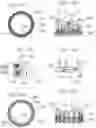 Fig. 13 - Assembly of heart valves and intermediate adapter stent