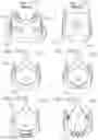 Fig. 17 - Assembly of heart valves and intermediate adapter stent
