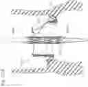 Fig. 24 - Assembly of heart valves and intermediate adapter stent