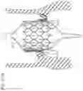 Fig. 25 - Assembly of heart valves and intermediate adapter stent