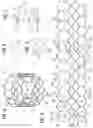 Fig. 03 - Prosthetic heart valve