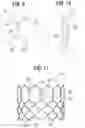 Fig. 04 - Prosthetic heart valve