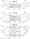 Fig. 27 - Prosthetic heart valve
