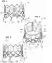 Fig. 02 - Prosthetic heart valve