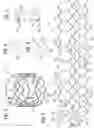 Fig. 03 - Prosthetic heart valve