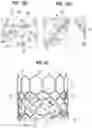 Fig. 07 - Prosthetic heart valve