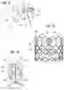 Fig. 12 - Prosthetic heart valve